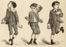 Энциклопедия - Хорея