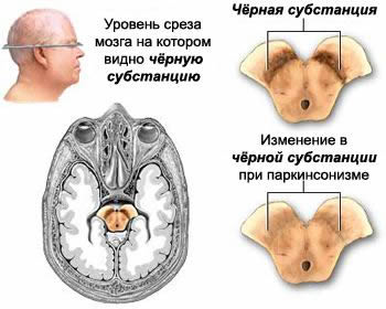 рефлекторная дуга спинного мозга строение. Смотреть фото рефлекторная дуга спинного мозга строение. Смотреть картинку рефлекторная дуга спинного мозга строение. Картинка про рефлекторная дуга спинного мозга строение. Фото рефлекторная дуга спинного мозга строение